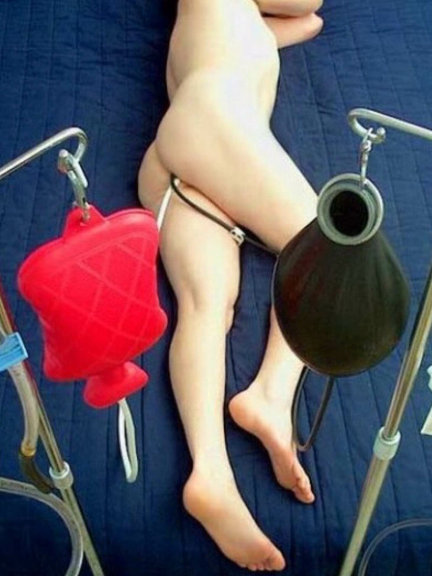 Black Bag Enema