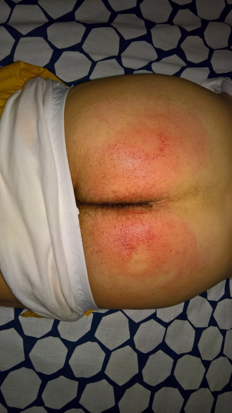Paddled Bottom